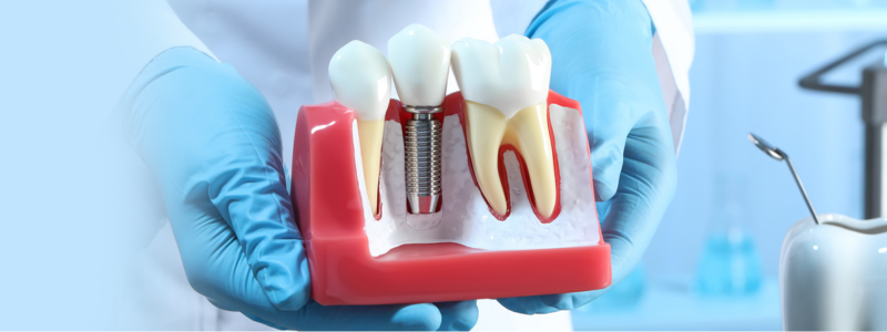 Dental implant