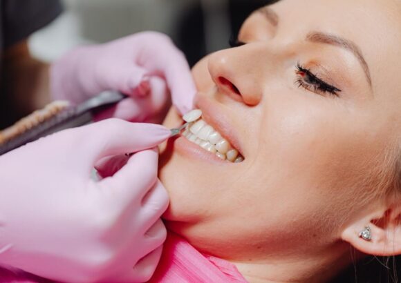 Dental Veneers - South Boston Dental Care