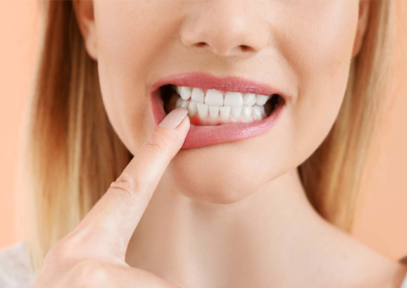 Understanding and Preventing Gum Disease