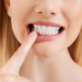 Understanding and Preventing Gum Disease