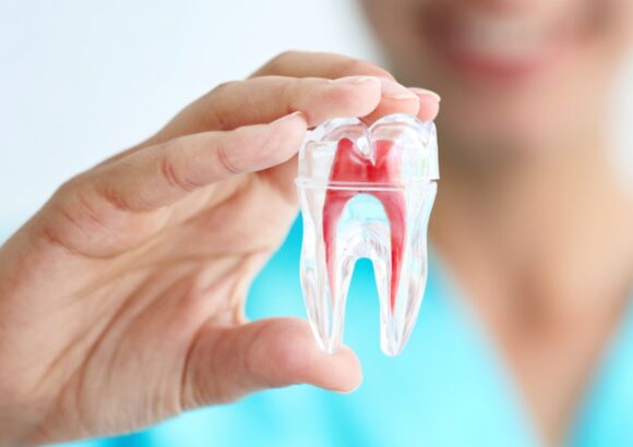 Root Canal Treatment - South Boston Dental Care